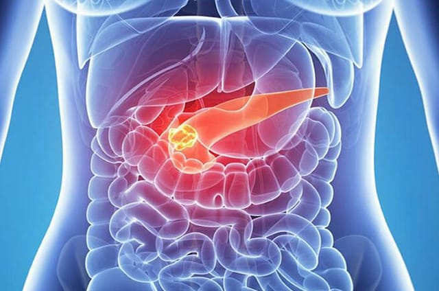 PANCRELEM (Панкрелем) Хао Ганг